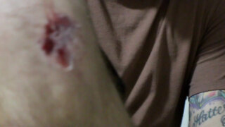 Lead Pastor Gets a Skateboard Injury!!!