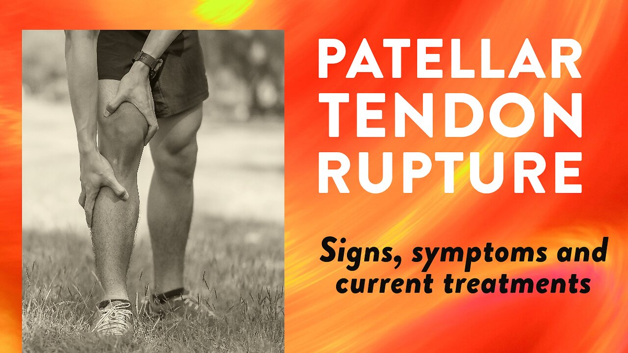 patellar-tendon-rupture-signs-symptoms-and-current-treatments