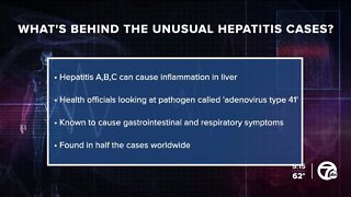 What to know about the rise in acute hepatitis cases in kids