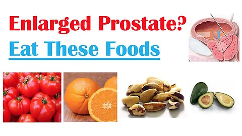 Best Foods to Eat with Enlarged Prostate | Reduce Risk of Symptoms, Enlargement & Cancer