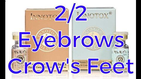 2/2 INNOTOX Jawline - Crow's Feet & Eyebrows