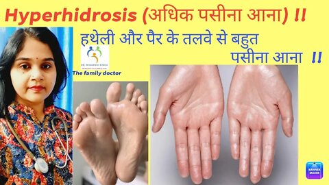 hyperhydrosis|| अधिक पसीना आना || हाथ पैर पसीने से गीले रहना||hyperhidrosis treatment at home