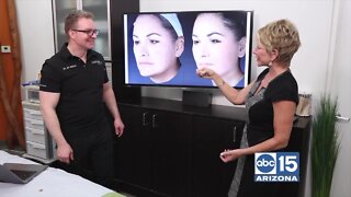 Contour Medical: Get a facelift without having surgery!