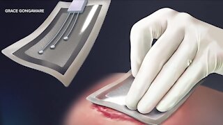 VA, CWRU researchers create 'Smart Bandage' to improve wound care for veterans