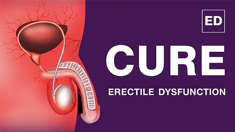 Shockwave Therapy for Erectile Dysfunction (ED) and Electromagnetic transduction treatment. (EMTT),