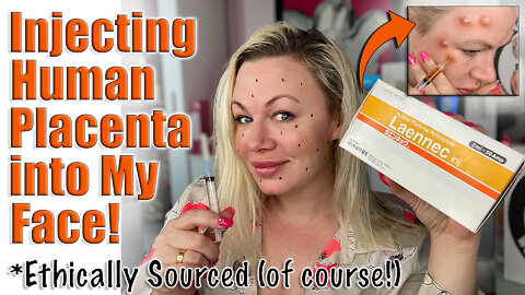 Injecting Human Placenta into my Face! Ethically Sourced from AceCosm | Code Jessica10 Saves you $$$