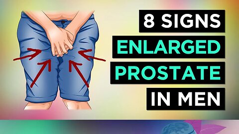 8 Signs You Have ENLARGED Prostate (BPH) | Men
