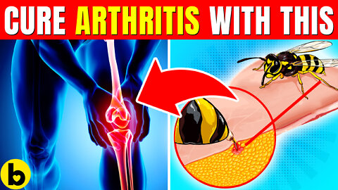 Bee Sting Venom May Actually Cure Arthritis