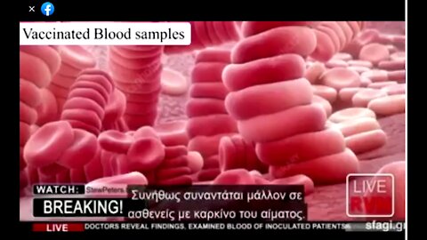 Serious Red Blood Cell Issues Found In Vaccinated Patients
