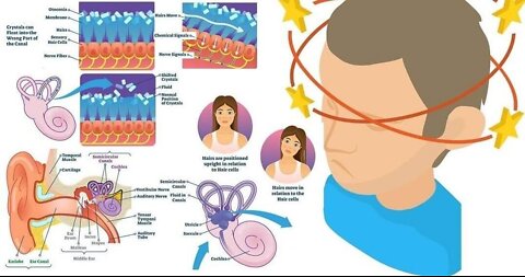 What is VERTIGO? What does VERTIGO mean? VERTIGO meaning, definition & explanation