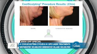 Coolsculpting Gets Results! // MD Body & Med Spa