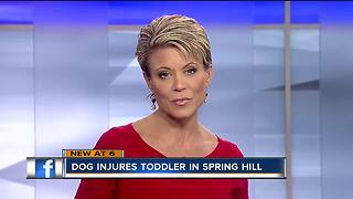 Toddler transported to trauma center after being bitten in head by family dog in Spring Hill