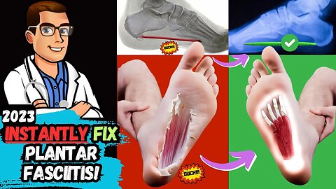 How To Cure Plantar Fasciitis FAST & FOREVER [Heel Pain & Heel Spurs]