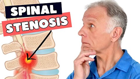 8 Fixes That Can Greatly Help Lumbar Spinal Stenosis