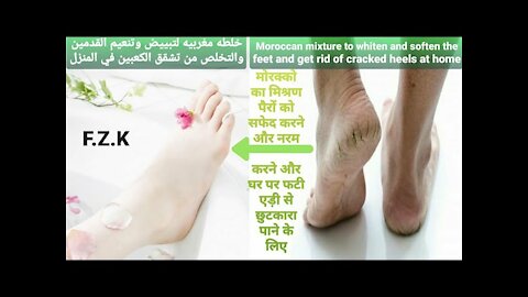 Moroccan mixture to whiten and soften the feet_get rid of cracked heels and moisturize them at home!