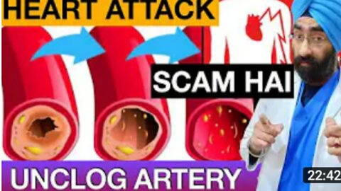 2nd Biggest Medical SCAM Heart Attack and Unclog Arteries I