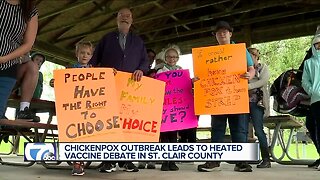 Chickenpox outbreak leads to heated vaccine debate in St. Clair county