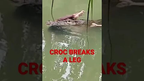 Foot In Mouth - Croc Bites a Human Leg