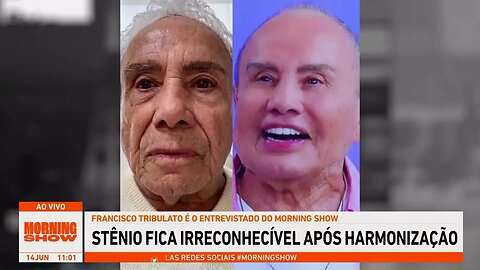 Stênio Garcia fica irreconhecível após procedimento de harmonização facial