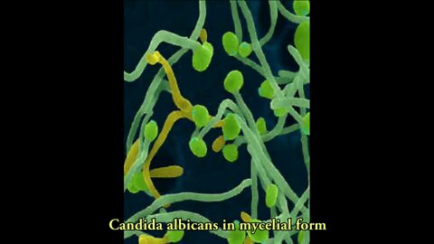 Cancer and the Candida Epidemic. Fight the Parasite. - FrequencyFence - Reptilians Shapeshifters