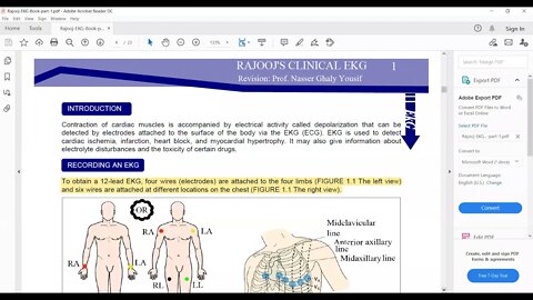 General medicine (RAJOOJ'S CLINICAL EKG)