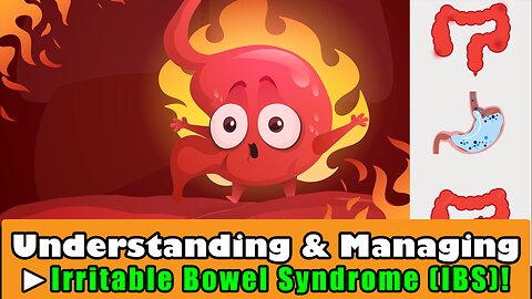 Understanding & Managing Irritable Bowel Syndrome
