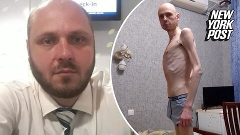 Shocking images of a former Ukrainian POW after being freed