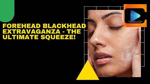 Forehead Blackhead Extravaganza - The Ultimate Squeeze!