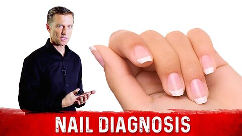 What do Your Nails Say About Your Health & Nutrition? – Dr.Berg