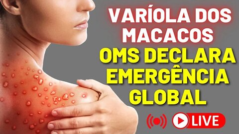 Varíola Dos Macacos - Tudo Que Você Precisa Saber Sobre a Varíola Dos Macacos