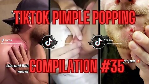 Nothing But CYSTS!!! | TikTok Pimple Popping Compilation - EP#35