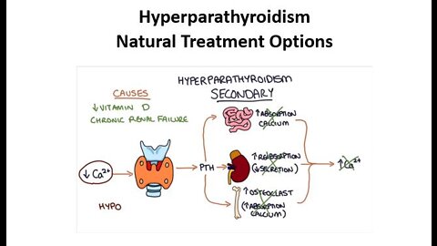 Hyperparathyroidism - Natural Treatment Options