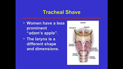 Tracheal Shave Transgender Studies