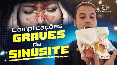 O QUE ACONTECE QUANDO NÃO TRATAMOS A SINUSITE?