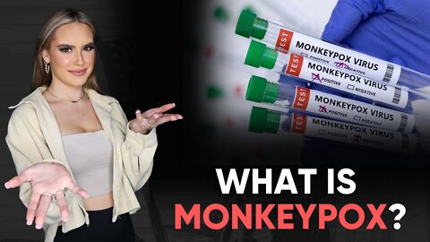 WHAT IS MONKEYPOX? | WHAT'S YOUR POINT?