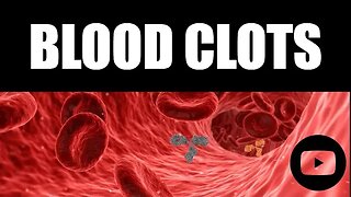 Blood Clots