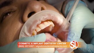 Dr. Valenzuela of Cosmetic & Implant Dentistry Center: Dental implants