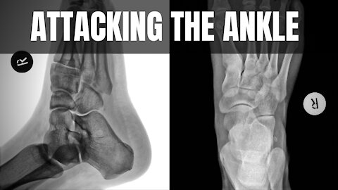 Joint Breaks: Attacking The Ankle