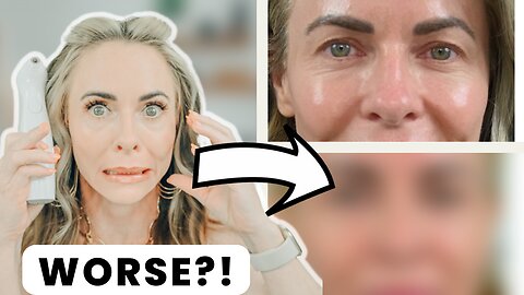 NIRA Skincare Laser | Does the Before & After Make Eyes Look Worse