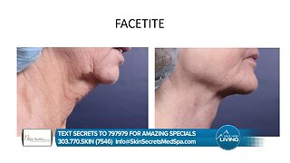 Skin Secrets- Non-invasive Procedures, Only Side Effect is A New Wardrobe