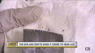 Head lice season is picking up; here's what you need to know