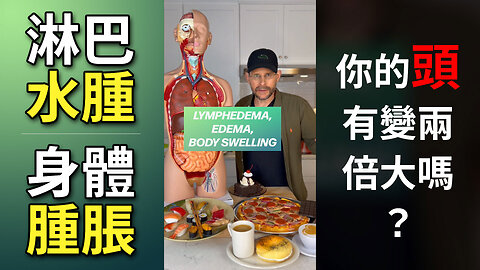 你的胖其實不是胖 Lymphedema, Edema, Body Swelling