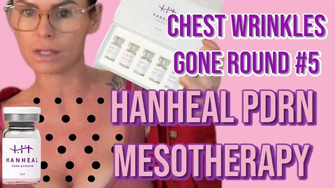 HANHEAL PDRN Chest Treatment Cleavage Wrinkles Gone - Acecosm CODE ( Holly10) SAVES MONEY