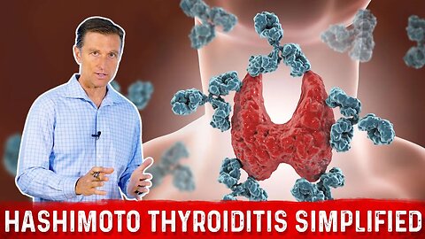 Hashimoto Thyroiditis (Autoimmune Hypothyroid) Simplified by Dr. Berg