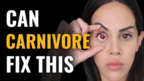 Why The Carnivore Diet CURES Glaucoma, Cataract, Macular Degeneration & Dry Eyes