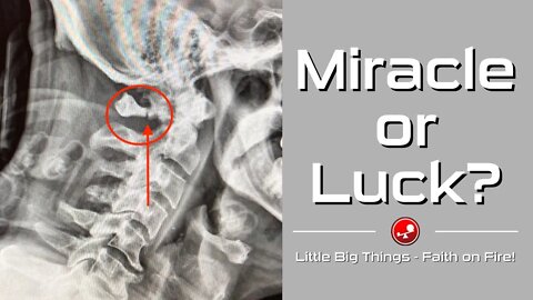 MIRACLE OR LUCK? - Daily Devotional - Little Big Things