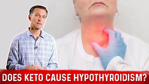 Does the Ketogenic Diet Cause Hypothyroidism or Hashimoto’s Thyroiditis – Dr. Berg