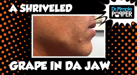 A Shriveled Grape in Da Jaw...