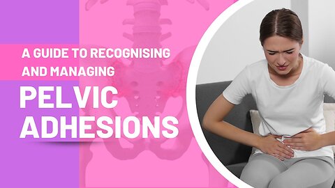 A Guide to Recognising and Managing Pelvic Adhesions
