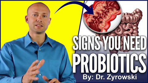 Probiotic Benefits | Top Signs You Should Be Taking A Probiotics
